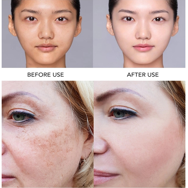 AILKE Super Whitening Face Ser - Vitamin C Serum Face reseña y precio