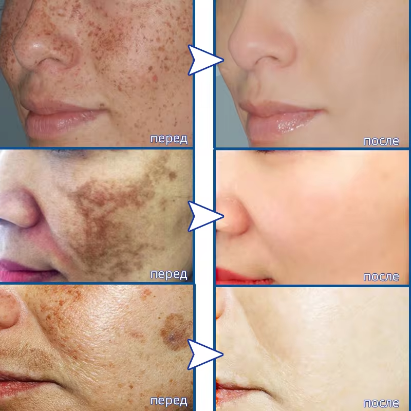 Powerful Spot-removing Whiteni - Vitamin C Serum Face reseña y precio