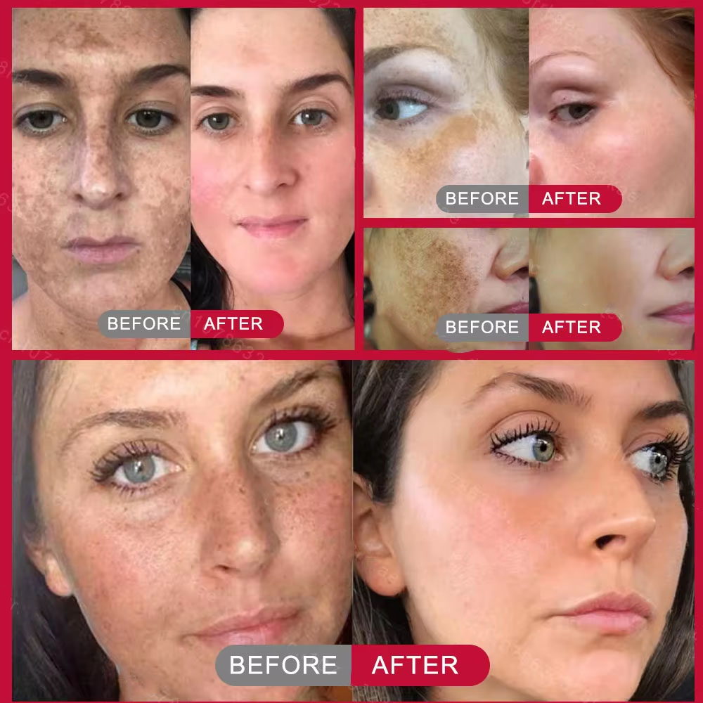 Powerful Spot-removing Whiteni - Vitamin C Serum Face reseña y precio