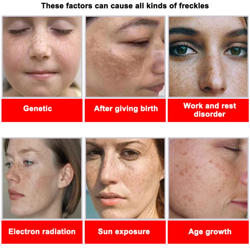 Powerful Spot-removing Whiteni - Vitamin C Serum Face reseña y precio