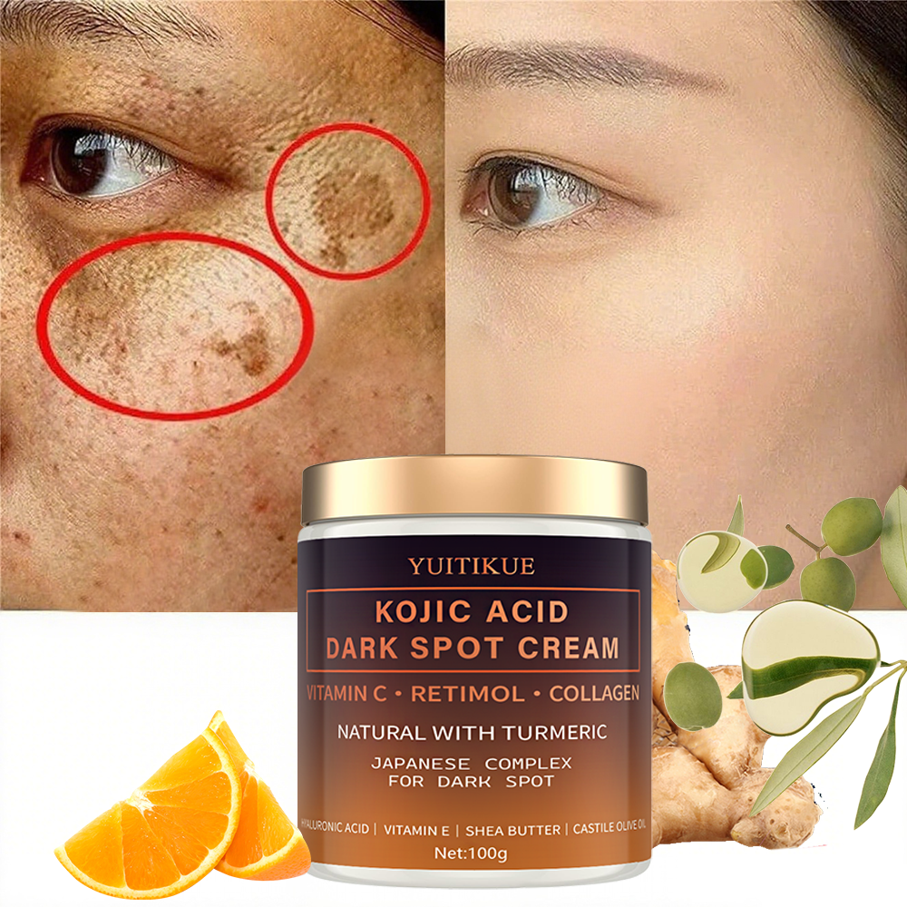 Arbutin fading cream, Vitamin  - Vitamin C Serum Face reseña y precio